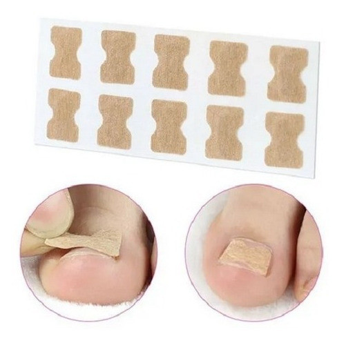 Corrector De Uñas  Encarnadas 10 Unidades 1