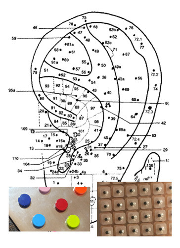 Auriculoterapia Kit Para Bajar De Peso 1
