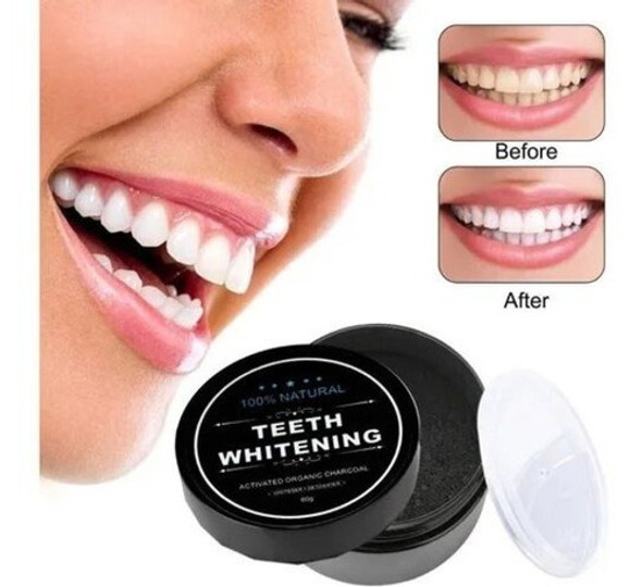 Blanqueador Dental Miracle Teeth Carbon Coco Natural No Daña 1
