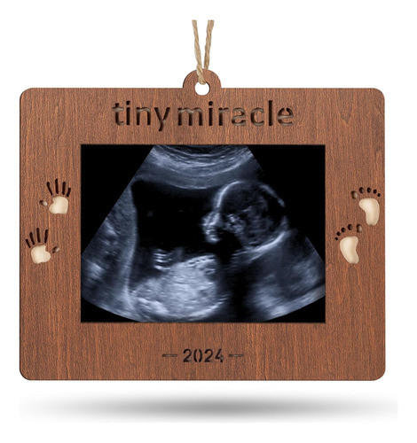 Marco De Fotos De Ultrasonido Ideal Para Regalo De Navidad 0