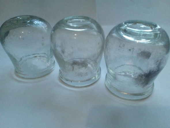 Ventosas Medicinal Lote 3 Antigua Imperdible 0
