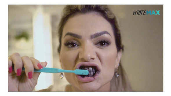 3 Branqueador Caseiro Dental Consultorio Paulo Zulu 1