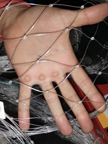 Malla De Contención 0