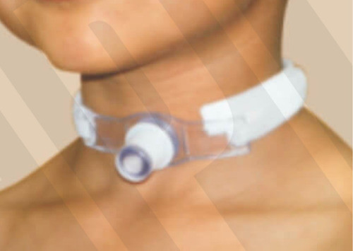 Fixador Para Cânulas De Traqueostomia Infantil 10 Unidades 1