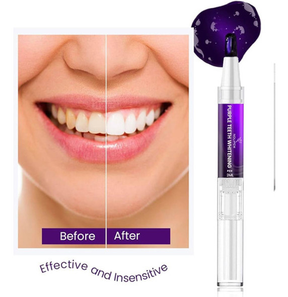 Lapiz Blanqueador Diente Instantaneo Violeta V34 Sin Mancha 1
