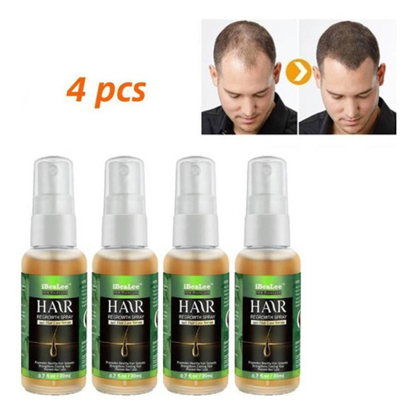 4pcs Ginger Hair Growth Spray Anti-queda De Cabelo Essência 0