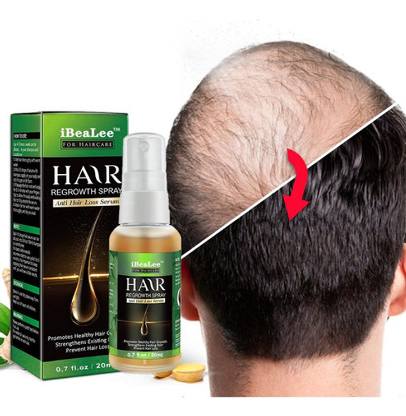 4pcs Ginger Hair Growth Spray Anti-queda De Cabelo Essência 1