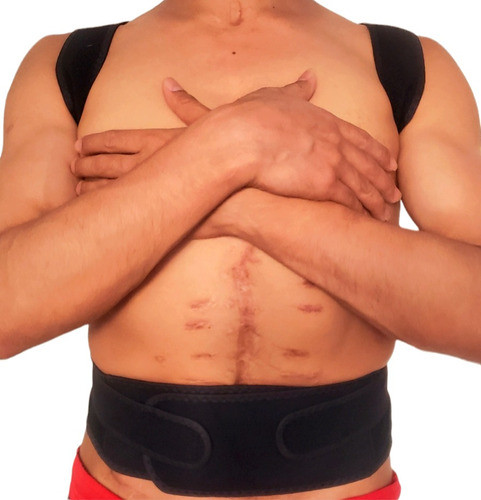 Corrector De Postura Espalda Postural Espaldera Importado 1