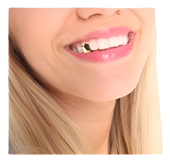 Grillz 14k Oro Plateado Solo Diente Parrilla Tapa Dientes Ca 0