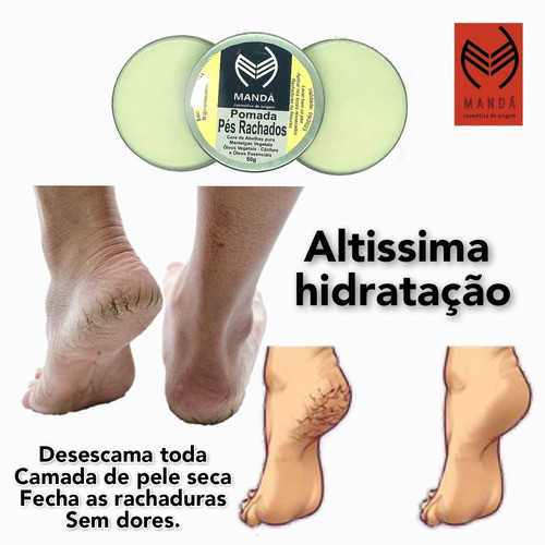 Kit 2 Pomadas Para Rachaduras E Pés Ressecados 1