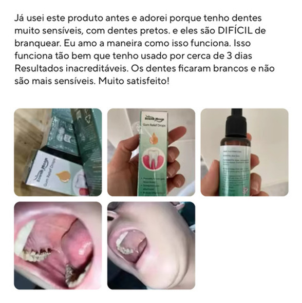 Clareador Dente Tártaro Dente Gengiva Dente Limpeza Total 1