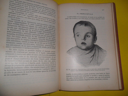 Enfermedades De Los Niños A Gilbert L Fournier 1917 Dr Apert 1