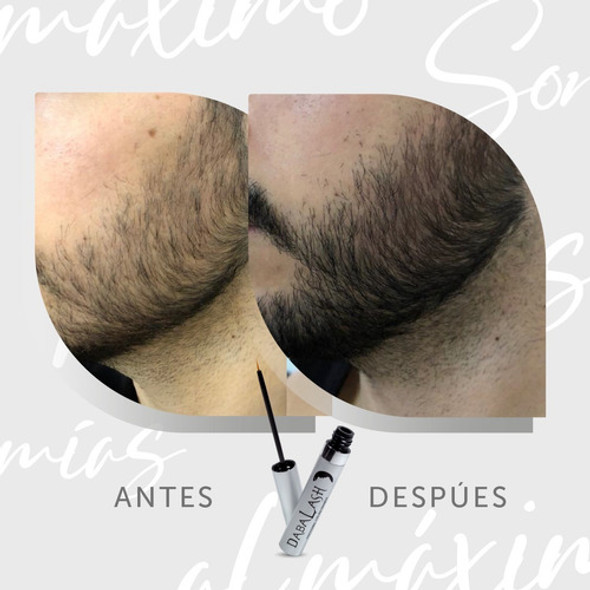 Estimulador Crecimiento Barba Bigotes Incentivador Distribuidor Oficial Dabalash Argentina 1