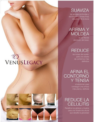 Alquiler Venus Legacy Equipo Esencial En Todo Estética 1