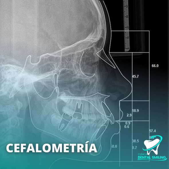 Cefalometría 1