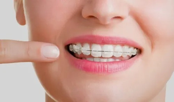 Cera Para Ortodoncia Dental Sin Sabor Pack X10 Cajas Maquira 1