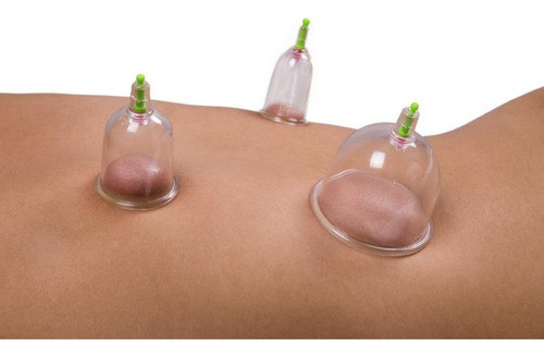 Ventosas Chinas Pistola De Vacio X24 Alivia Dolores Tension Musculo Copas Oferta Nuevas Super Oferta 0