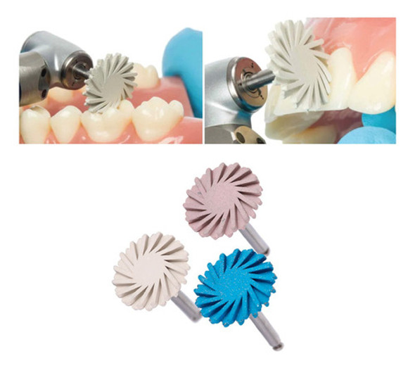 Discos De Pulido Profesional Para Composite Twist X3 Odonto 1