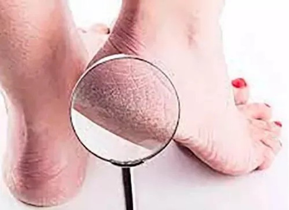 Locion Pedica Ablanda + Crema Restauradora 250ml Biobellus 1