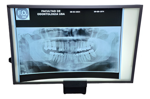 Negatoscopio Led De Escritorio Extra Brillo (25cm X 30cm) 1