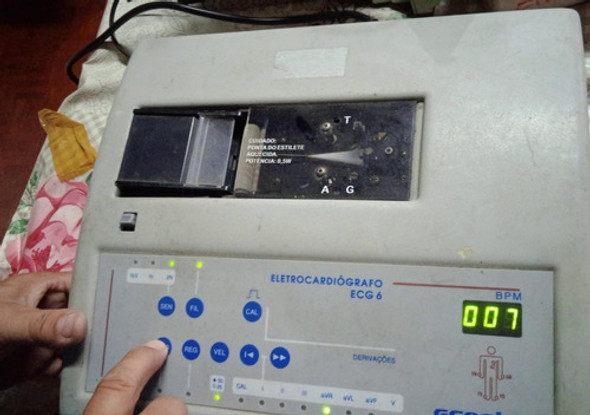 Eletrocardiógrafo Ecafix Para Retirar Peças 0