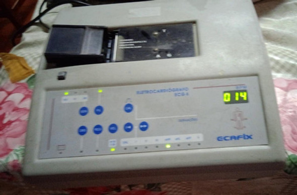 Eletrocardiógrafo Ecafix Para Retirar Peças 1