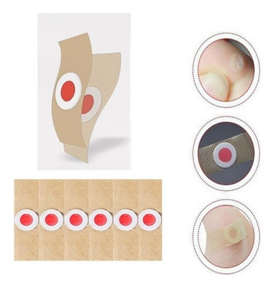 200 Adesivos Para Remover Calos, Verrugas E Olhos De Peixe 1