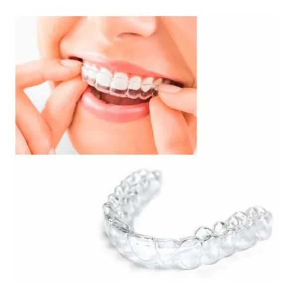 Placa De Contencion Post Ortodoncia 0