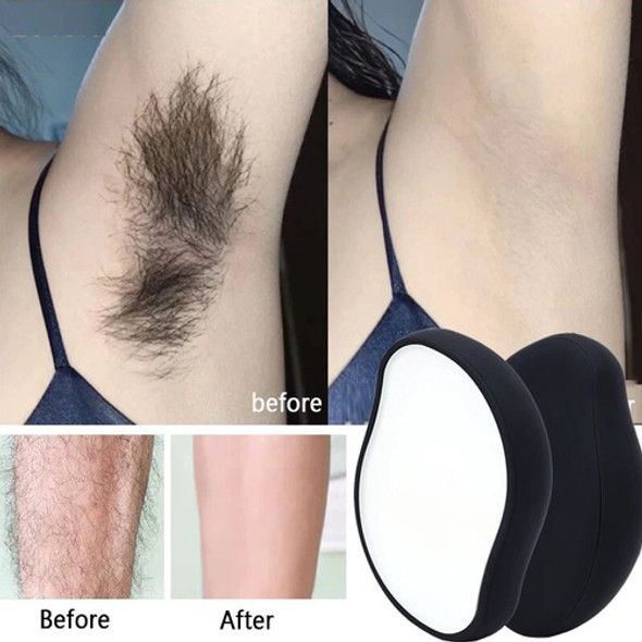 Removedor De Cabelo Seguro E Indolor, Depilador Físico, Axil 1