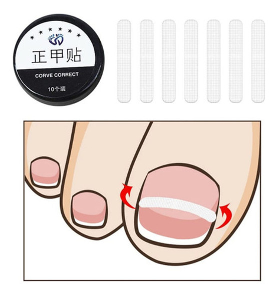 Fibra Órtese De Memória Molecular 0,22mm 10 Peças Podologia 0