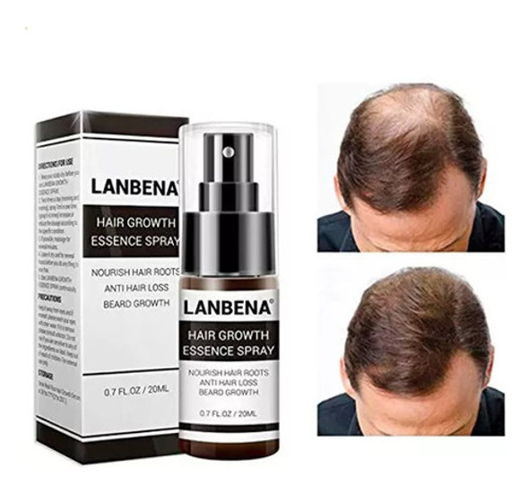 Crecimiento Capilar Caida Del Pelo Fortalecedor  Lanbena 0 Crecimiento Capilar Caida Del Pelo Fortalecedor  Lanbena 0
