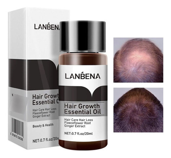Crecimiento Capilar Caida Del Pelo Fortalecedor  Lanbena 0 Crecimiento Capilar Caida Del Pelo Fortalecedor  Lanbena 0