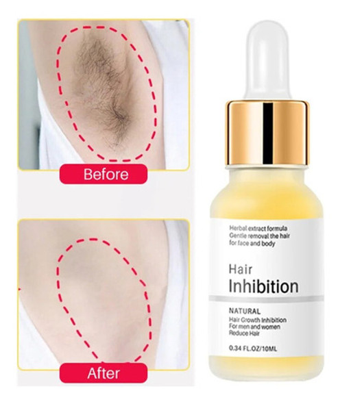Sérum De Inibição Permanente Do Cabelo, Removedor De Cabelo 0