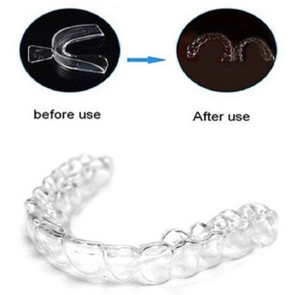 Protetor Bucal Moagem De Dentes Protetores De Dentes 1