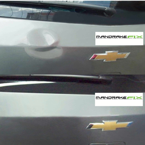 Kit Ventosa Martelinho De Ouro Repuxadeira Manual 3 Peças 1