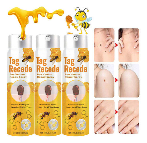 3 Unidades De Creme Removedor De Verrugas Genitais, 20 Ml 0