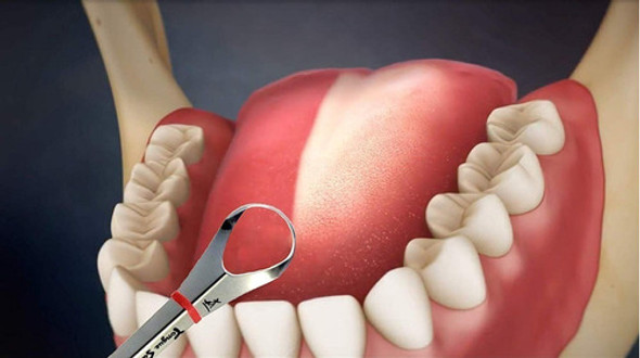 Limpador De Língua Importado Em Aço Inox Cirúrgico 1