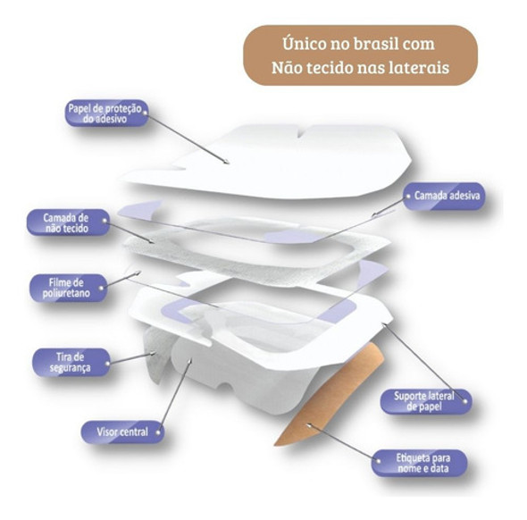 Curativo De Fixação Transparente Iv M-tec 20 Un 10x12 Cm 1