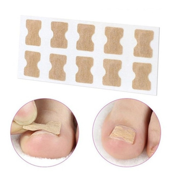 Adesivo Correção Unha Encravada Kit Com 20 Peças 10 Pares 0