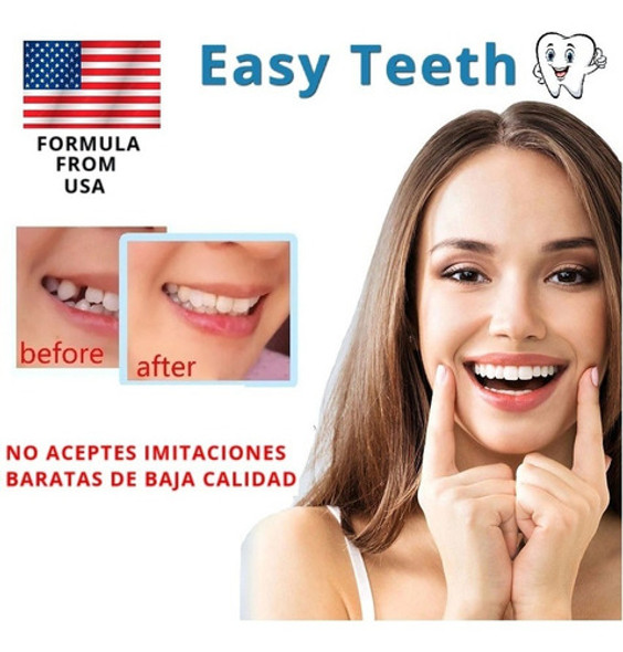 Diente Provisorio Protesis Dental Diente Muela 1