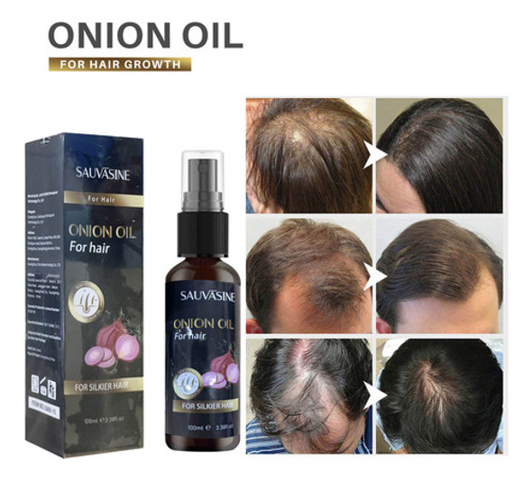 Óleo Essencial De Cebola Para Cuidados Com O Cabelo Para Ama 1