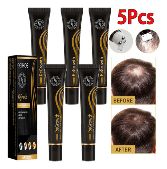 Dd Sérum Biotina Para Crescimento Capilar 5pcs 0