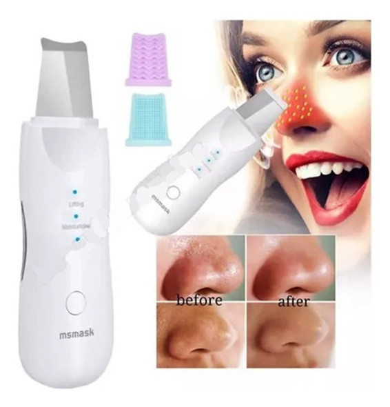 Espátula Facial Ultrasónica Peeling Skin Scrubber Recargable 1 Espátula Facial Ultrasónica Peeling Skin Scrubber Recargable 1