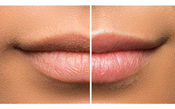 Exfoliante De Labios 1