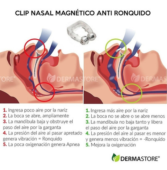 X2 Kit Combo Antironquido Dejar De Roncar Clip + Soporte 1 X2 Kit Combo Antironquido Dejar De Roncar Clip + Soporte 1