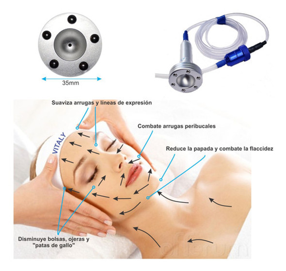 Cabezal De Masaje Vacumterapia Facial D 35 Vitaly 1 Cabezal De Masaje Vacumterapia Facial D 35 Vitaly 1