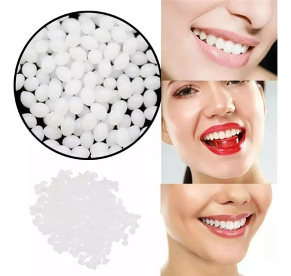 Kit Diente Provisorio Para Reemplazar Un Diente Easy Tooch 1