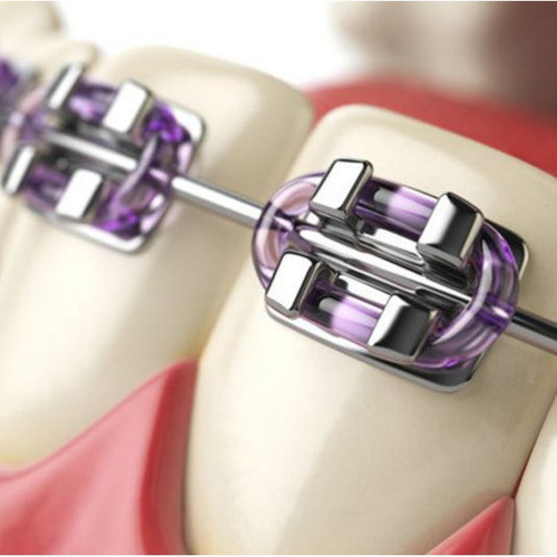 Goma Para Brackets Individual. Sueltas O Paquete. Cant. 50 1