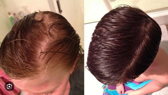 1 Lt Aceite Ricino Caida De Cabello Oferta No Selo Pierda 1