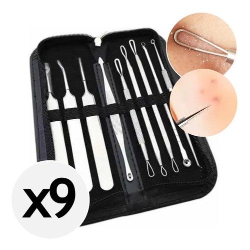 Extractor De Granos Puntos Negros Comedones Kit 9 Piezas 0